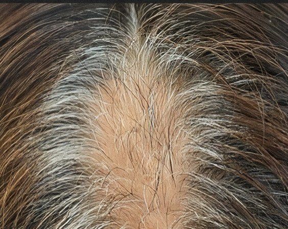 Scalp from above, 3rd session